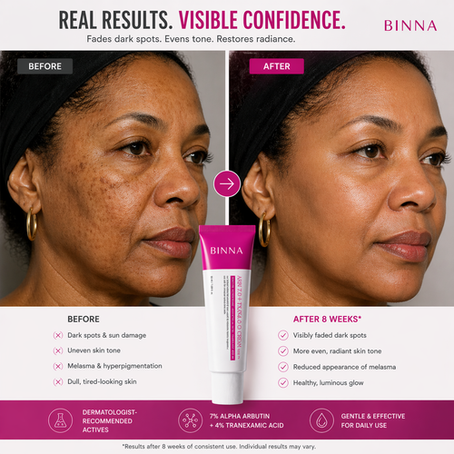 Binna 빛나 7% Arbutin + 4% Tranexamic Acid